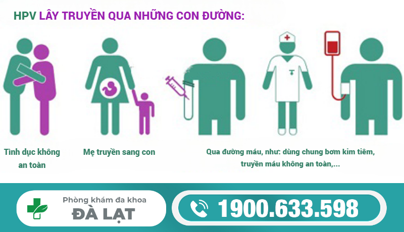 Hình ảnh minh họa